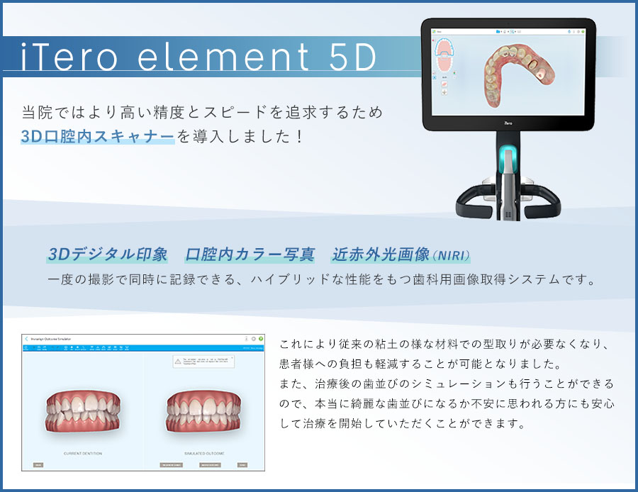 iTero element 5D 当院ではより高い精度とスピードを追求するため3D口腔内スキャナーを導入しました！
