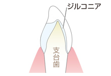 レイヤリング