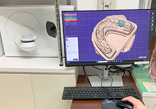 CAD/CAM