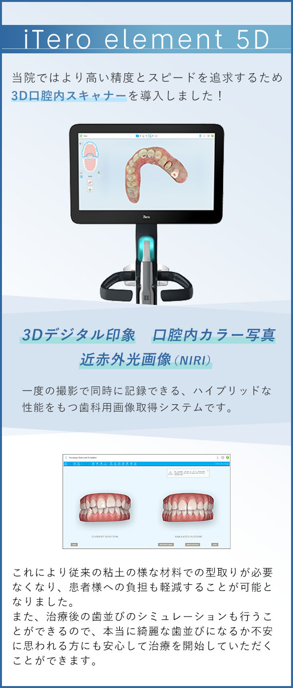 iTero element 5D 当院ではより高い精度とスピードを追求するため3D口腔内スキャナーを導入しました！